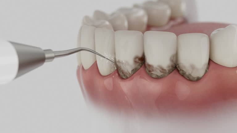 Trusted Invisalign Clear Aligners service in Starke, FL - Dentist Open Now
